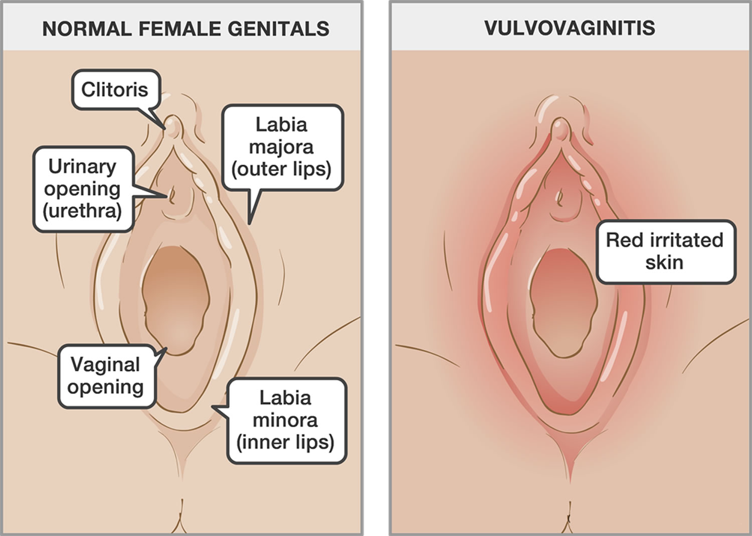 Swollen vagina and clitoris