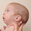 Pierre-Robin-syndrome