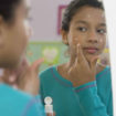 acne in children