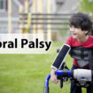 cerebral palsy