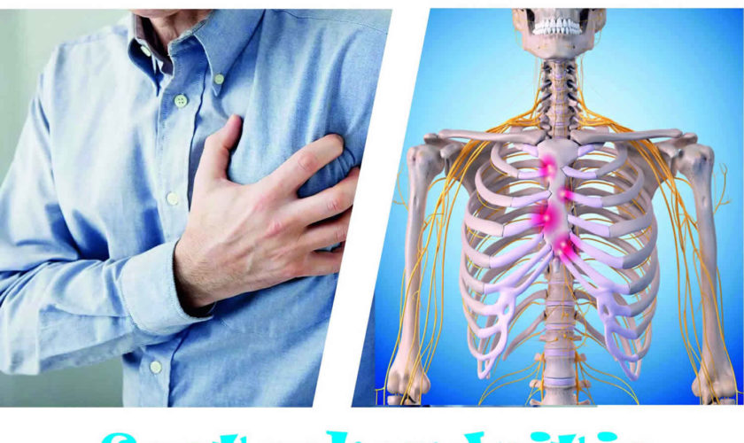 costochondritis