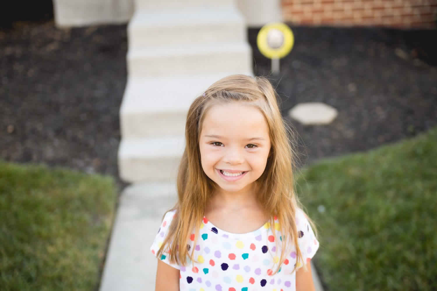 Mosaic Down Syndrome Causes Symptoms Diagnosis Life Expectancy