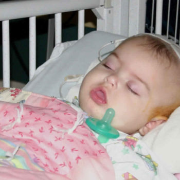 shaken baby syndrome