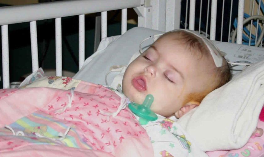 shaken baby syndrome