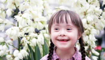 translocation down syndrome