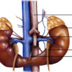 Horseshoe-kidney