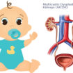 Multicystic-dysplastic-kidney