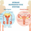 androgen insensitivity syndrome