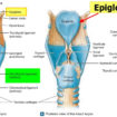 epiglottis