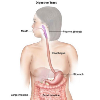 juvenile polyposis syndrome