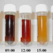 paroxysmal nocturnal hemoglobinuria