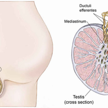 testicular examination